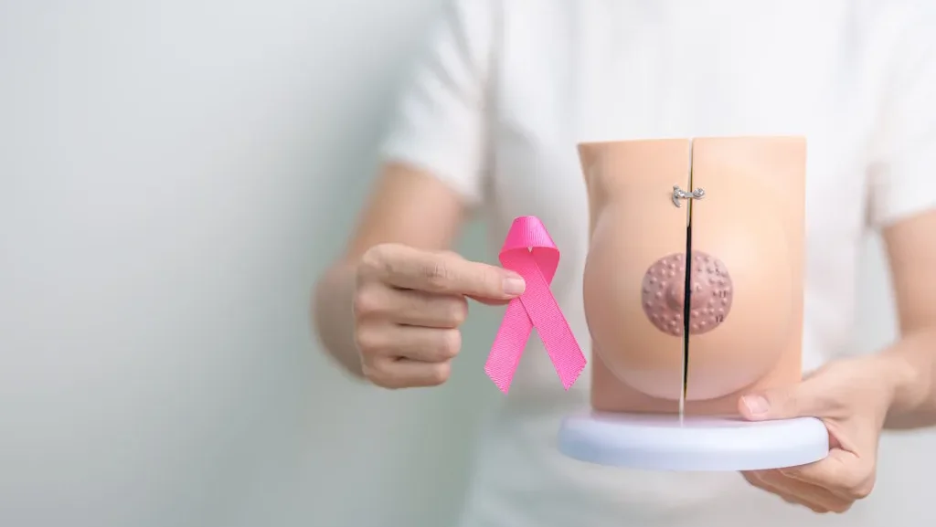 Cancro Mama