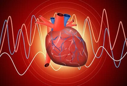 Choque Cardiogénico